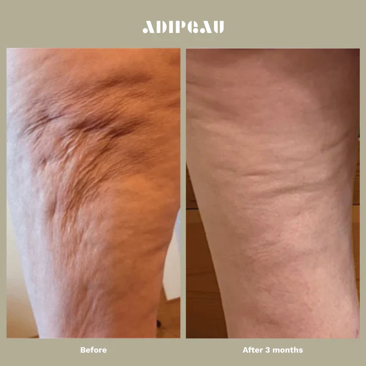 Adipeau - Strength Gel - Image 4