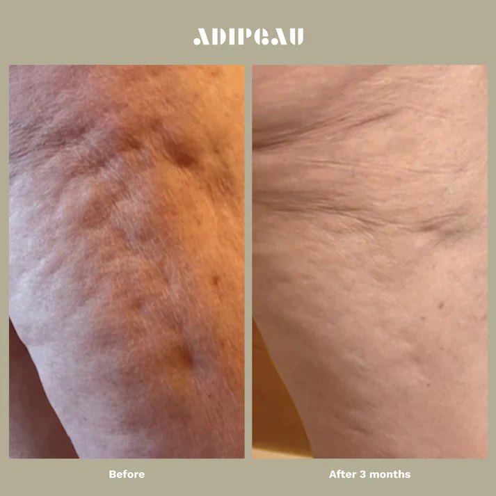 Adipeau - Strength Gel - Image 5