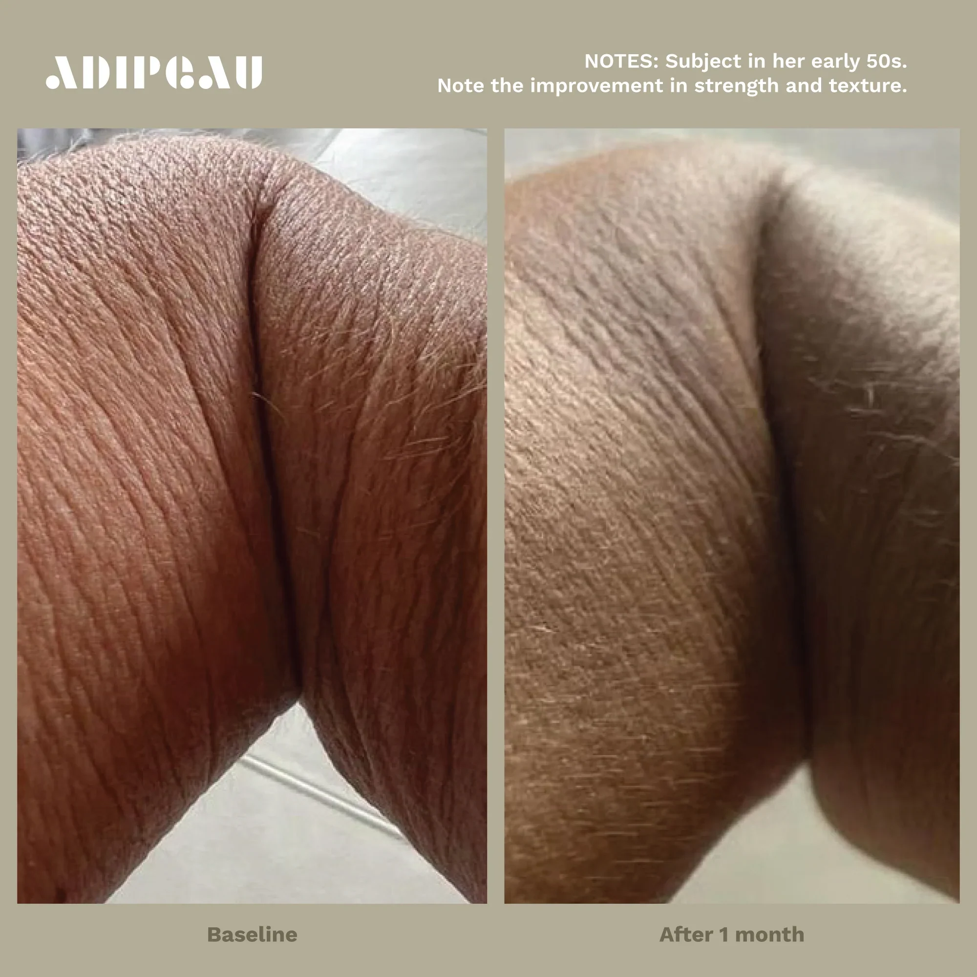 Adipeau - Strength Gel - Image 6