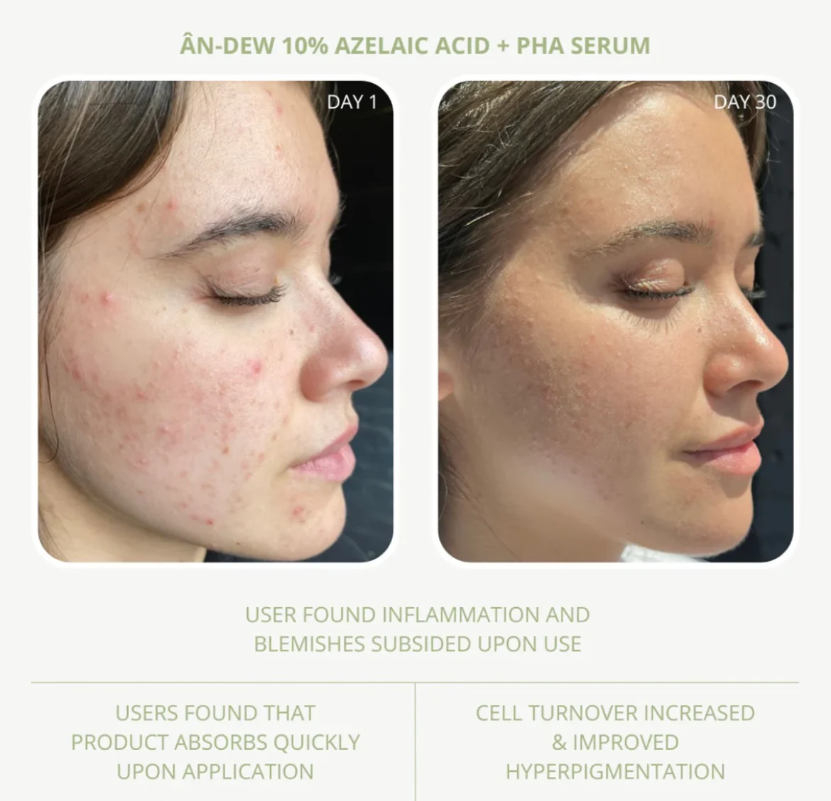 ÂN-DEW 10% Azelaic Acid + PHA Serum - Image 4