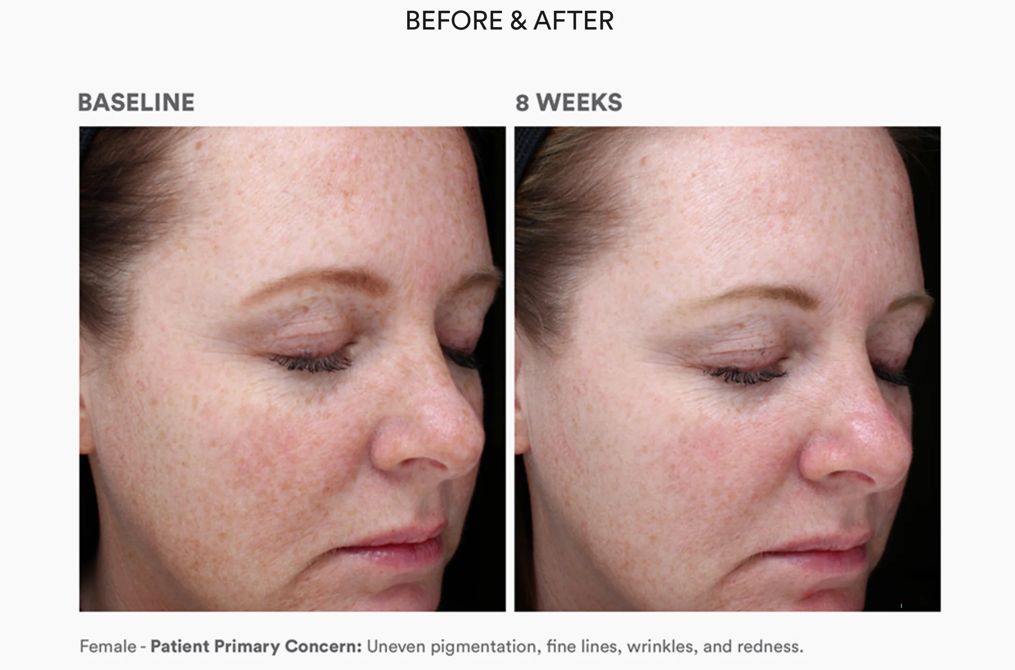 Bio Complete Serum - Image 3