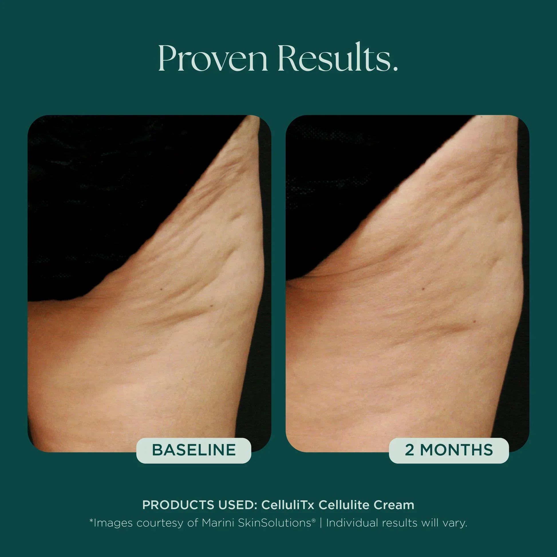 CelluliTX Cellulite Cream - Image 6