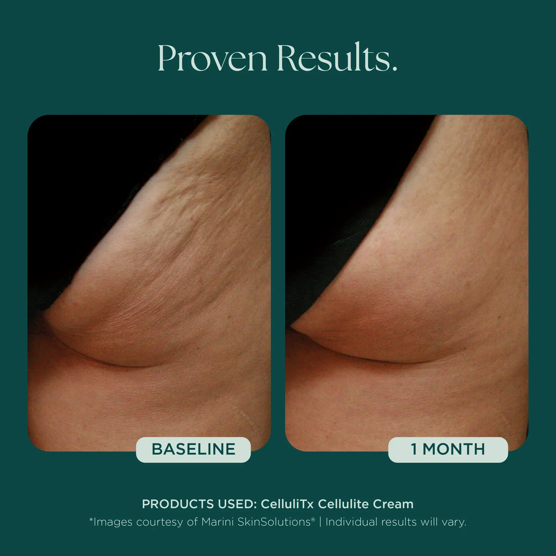 CelluliTX Cellulite Cream - Image 7