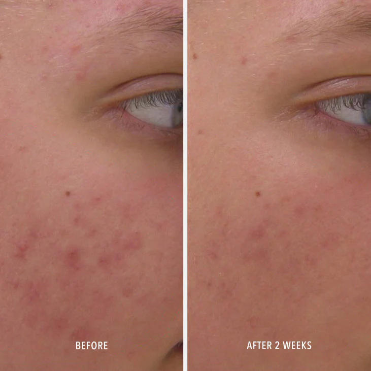 CLEAR RESCUE - Skin-Refining Serum - Image 3