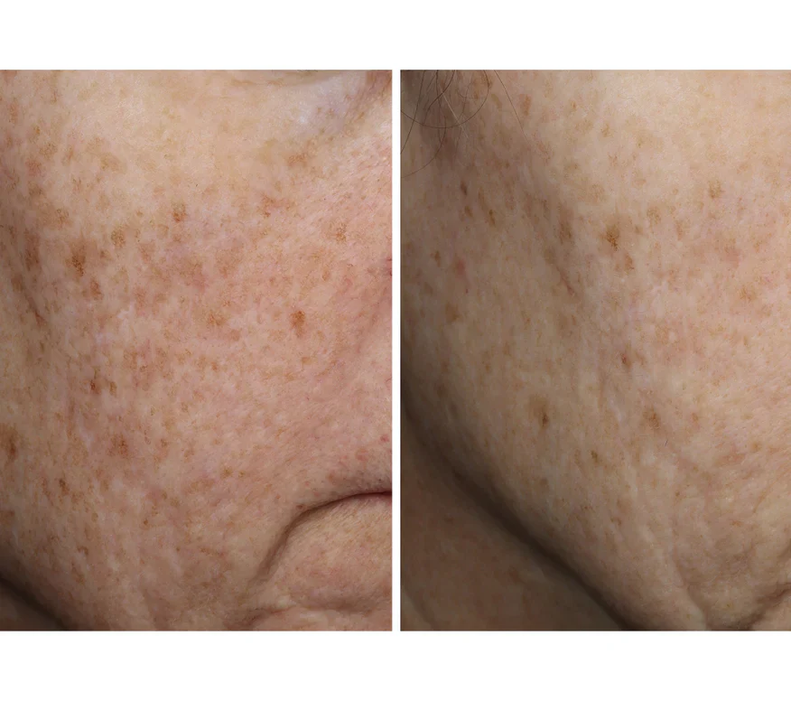 Complexion Brightening Serum - Image 3