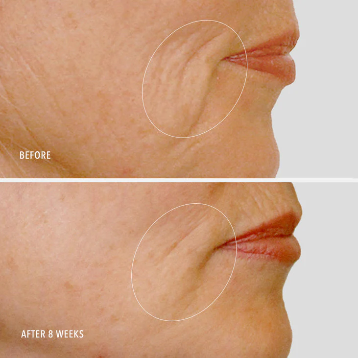DAILY DRENCH - Hyaluronic Acid Peptide Booster - Image 5