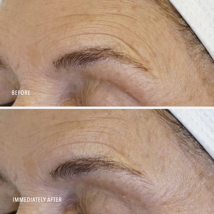 DAILY DRENCH - Hyaluronic Acid Peptide Booster - Image 6