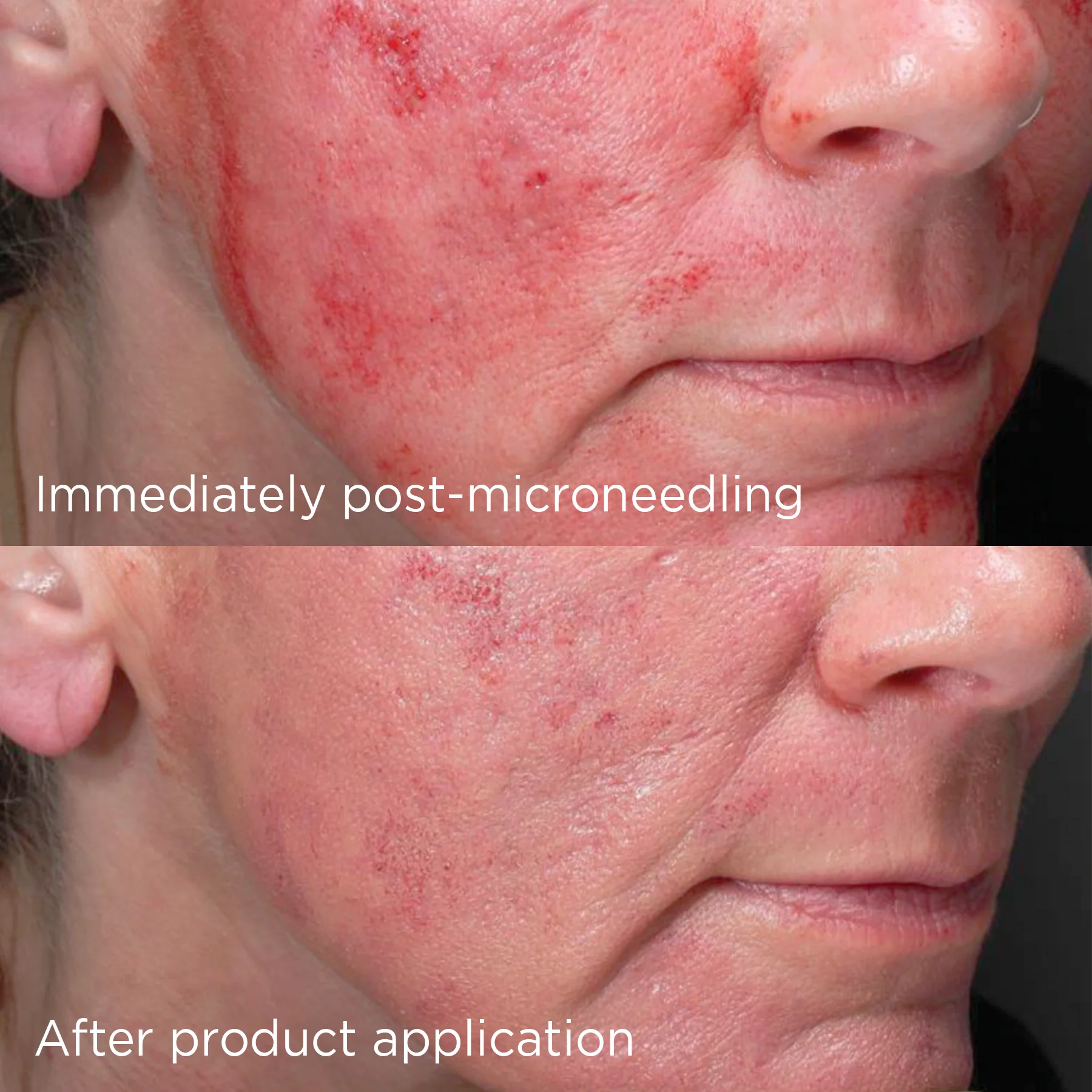 DAILY PREVENTION advanced smartblend mineral moisturizer SPF 75 - Image 5