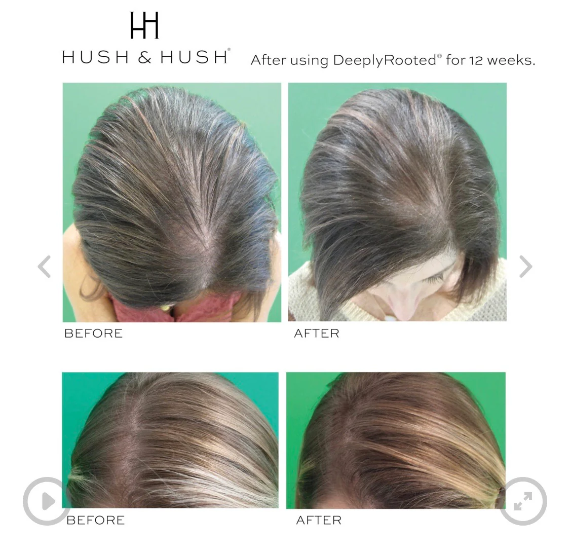DeeplyRooted (Hair Health) - Image 4
