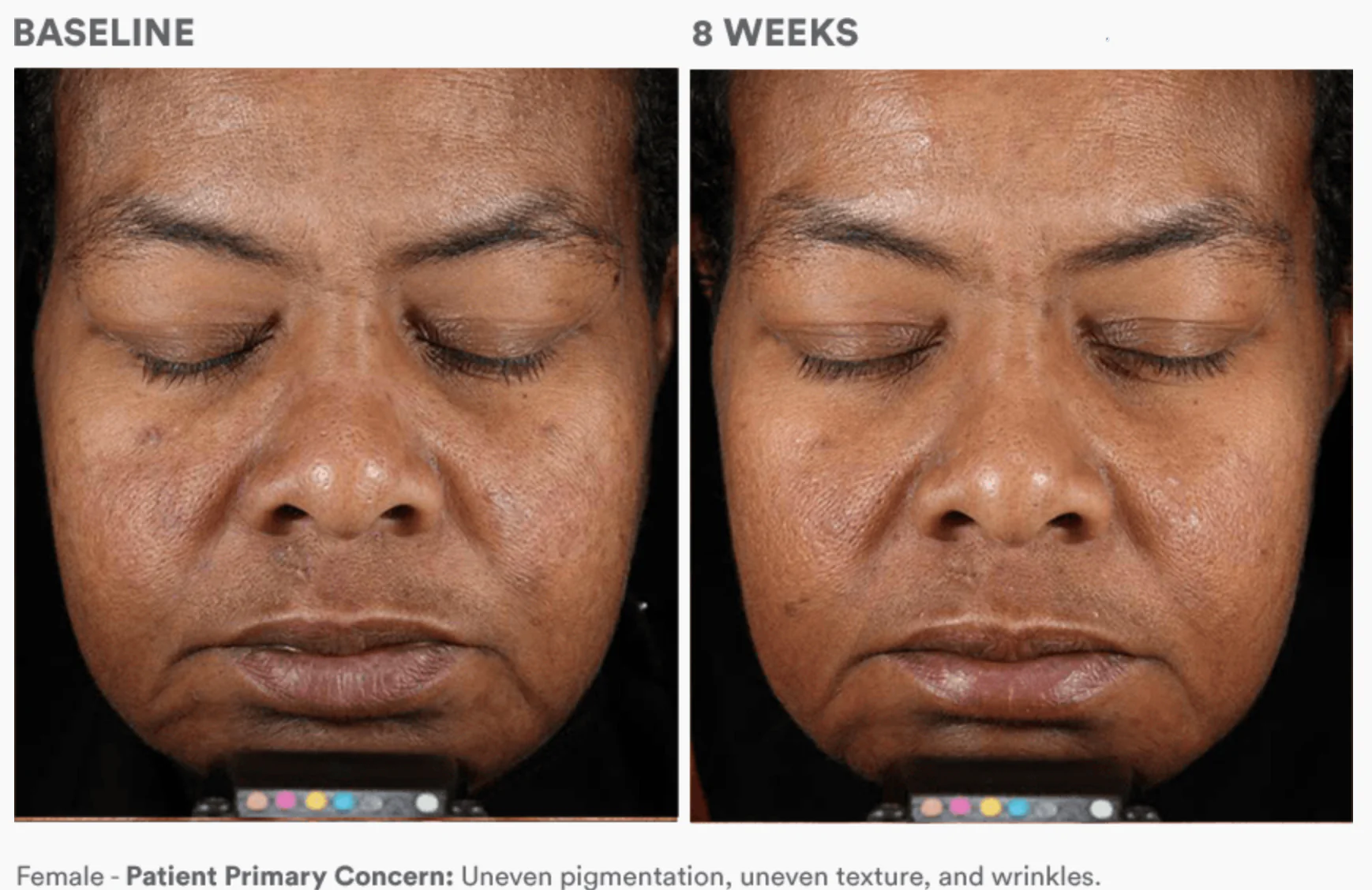 Dermal Repair Cream - Image 4