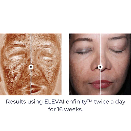 Enfinity Serum - Image 3