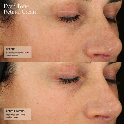 Even Tone Retinol Cream - Image 3