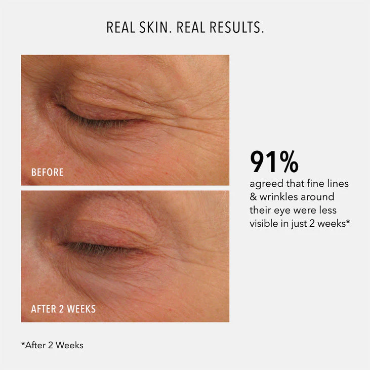 EYE AUTHORITY - Dark Circles, Puffiness, Fine Lines - Image 3