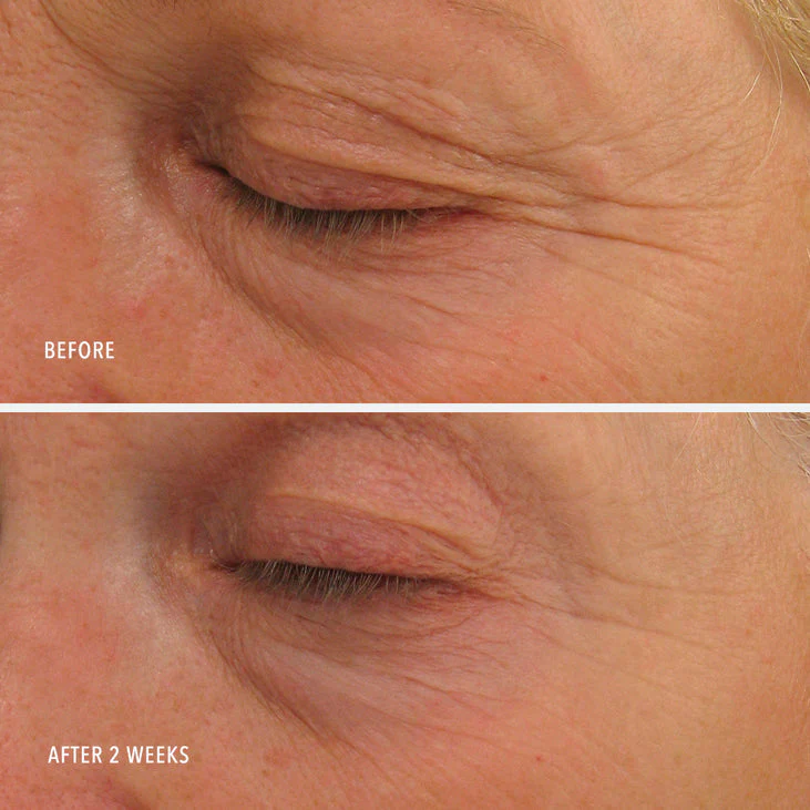 EYE AUTHORITY - Dark Circles, Puffiness, Fine Lines - Image 4