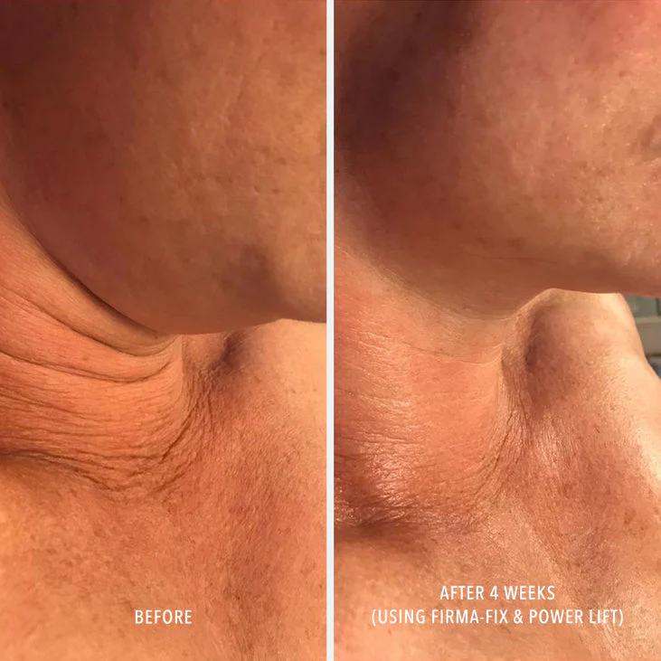 FIRMA-FIX NECTAR - Lifting Neck & Décolleté Serum - Image 3