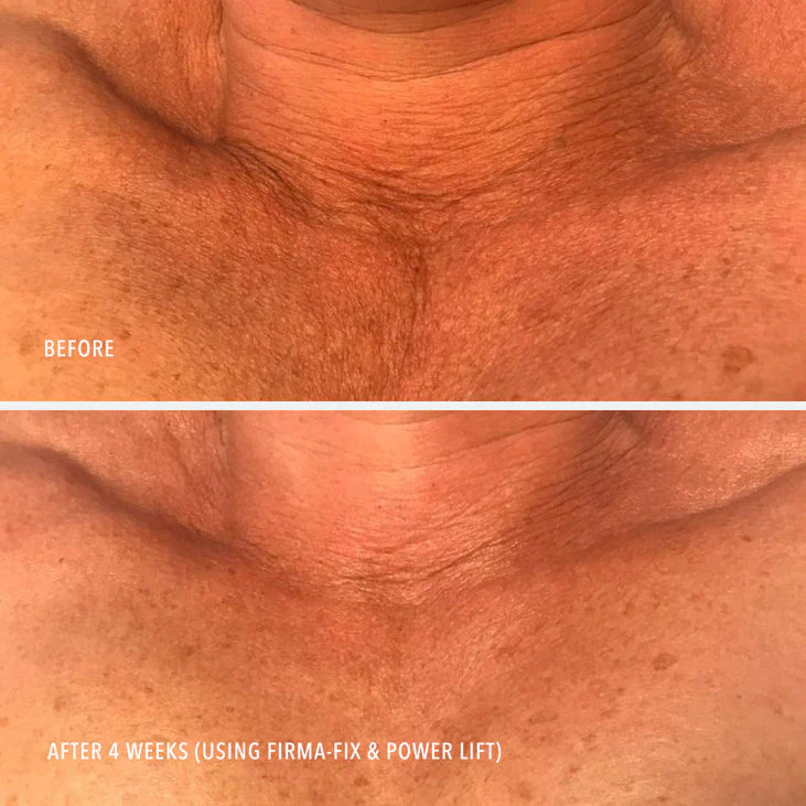 FIRMA-FIX NECTAR - Lifting Neck & Décolleté Serum - Image 4