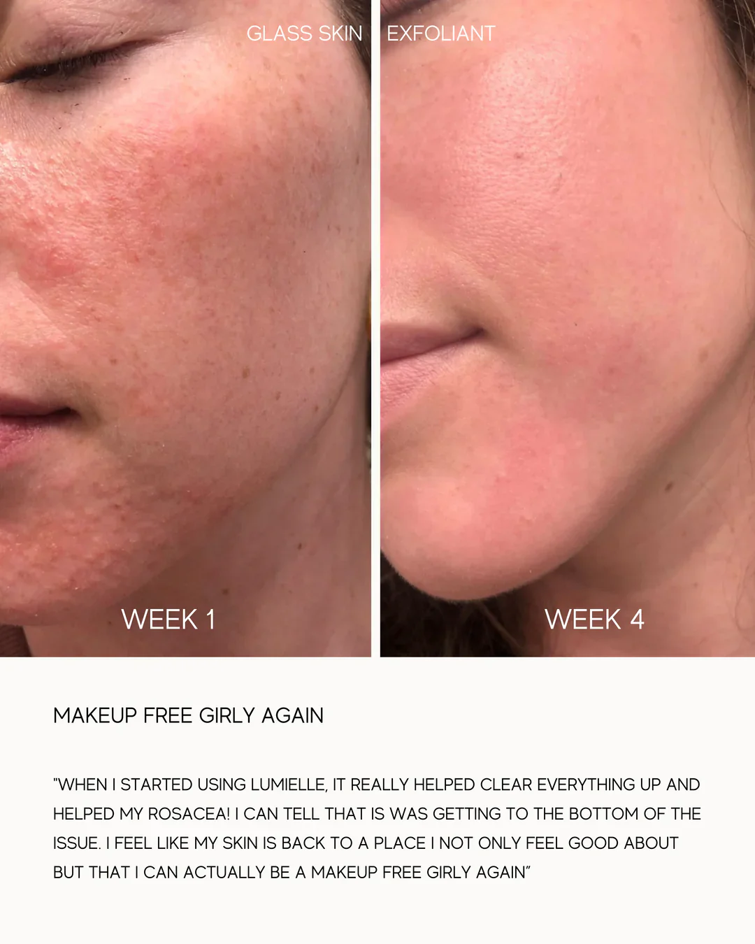 Glass Skin Liquid Exfoliant - Image 6