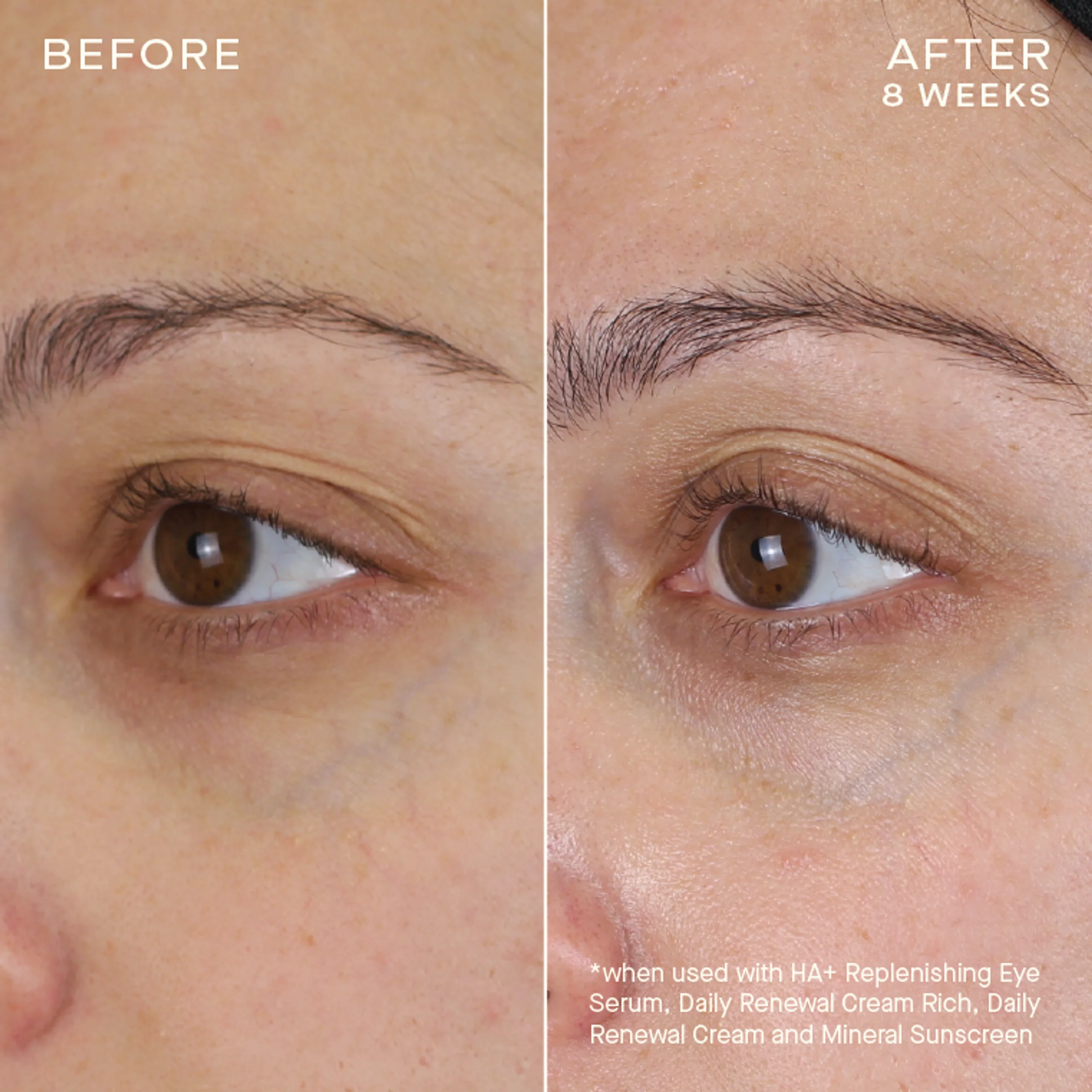 HA+ Replenishing Eye Serum - Image 8