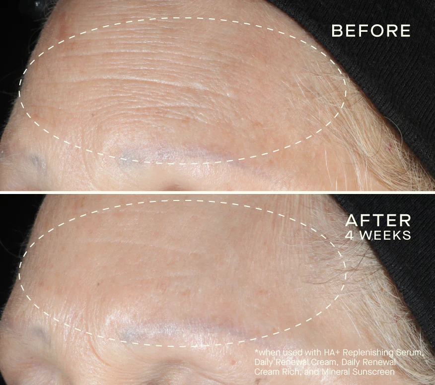 HA+ Replenishing Serum 30mL - Image 7