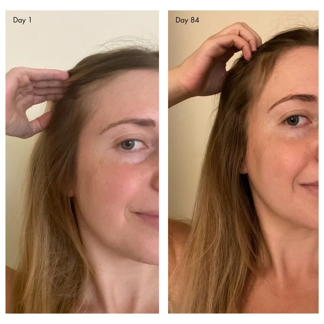 holi (growth) 84 leave-in hair growth scalp spray - Image 2
