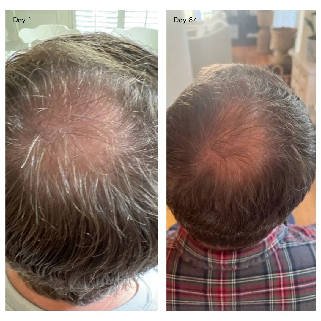 holi (growth) 84 leave-in hair growth scalp spray - Image 3