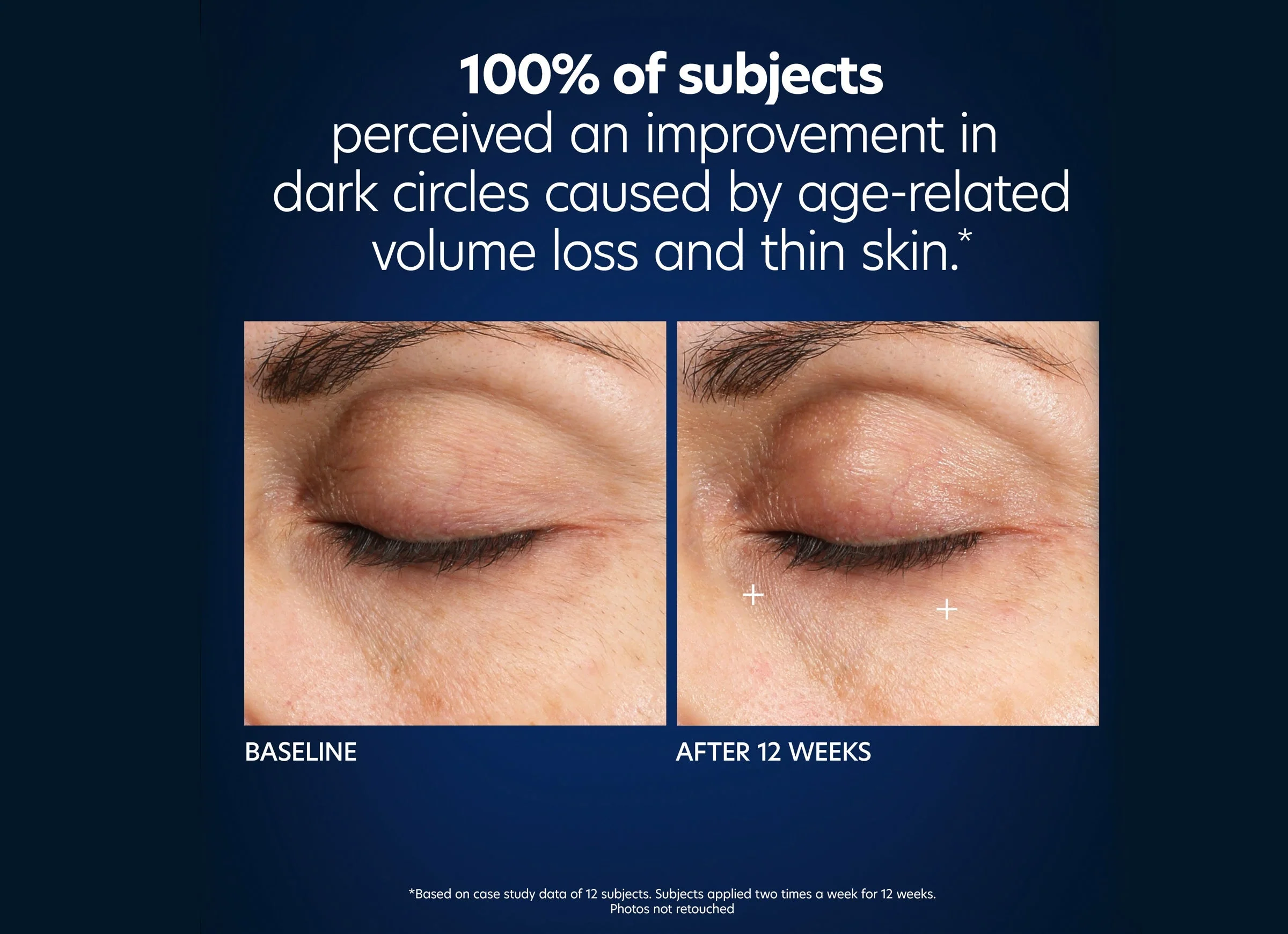 Hyaluronic Acid Microneedle Eye Patches - Image 6