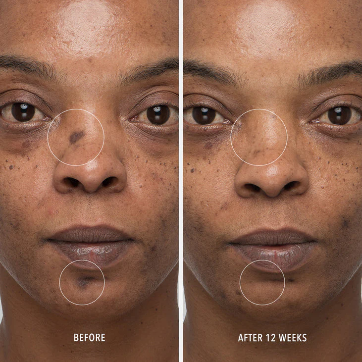INNERDERM RX - Daily Skin Health Supplement - Image 4