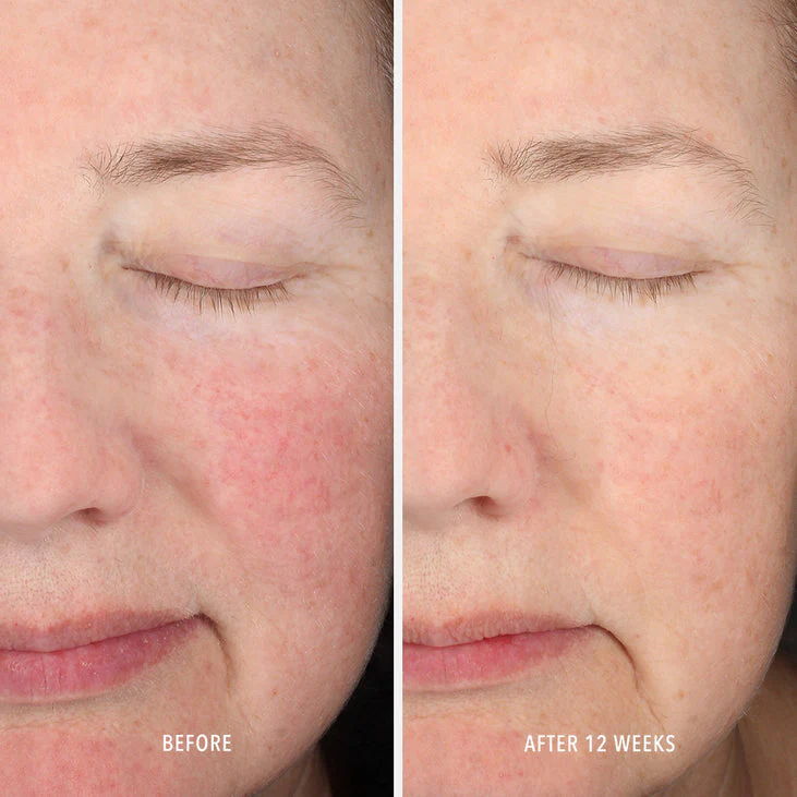 INNERDERM RX PLUS - Daily Skin Health Supplement - Image 6