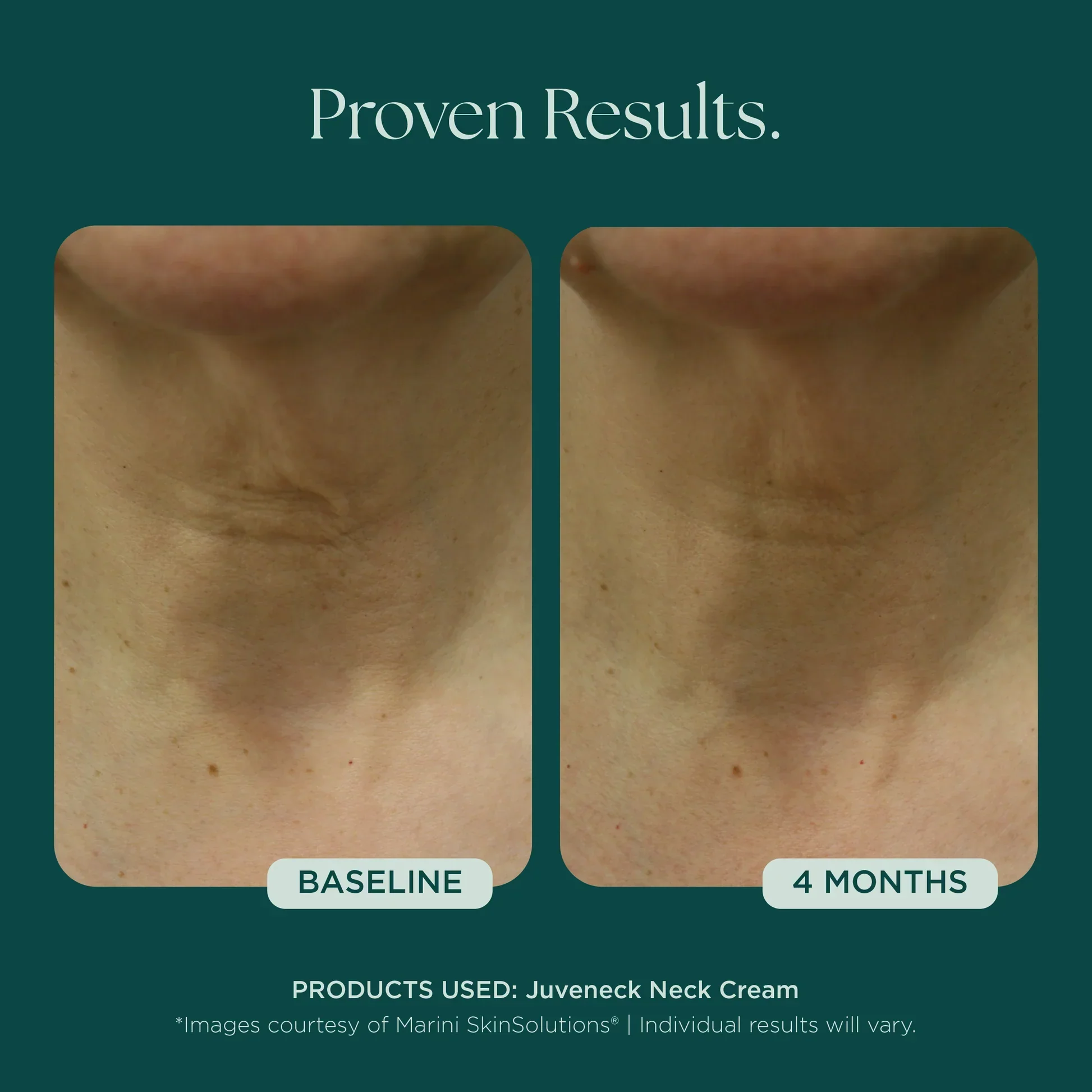 Juveneck Neck Cream - Image 3