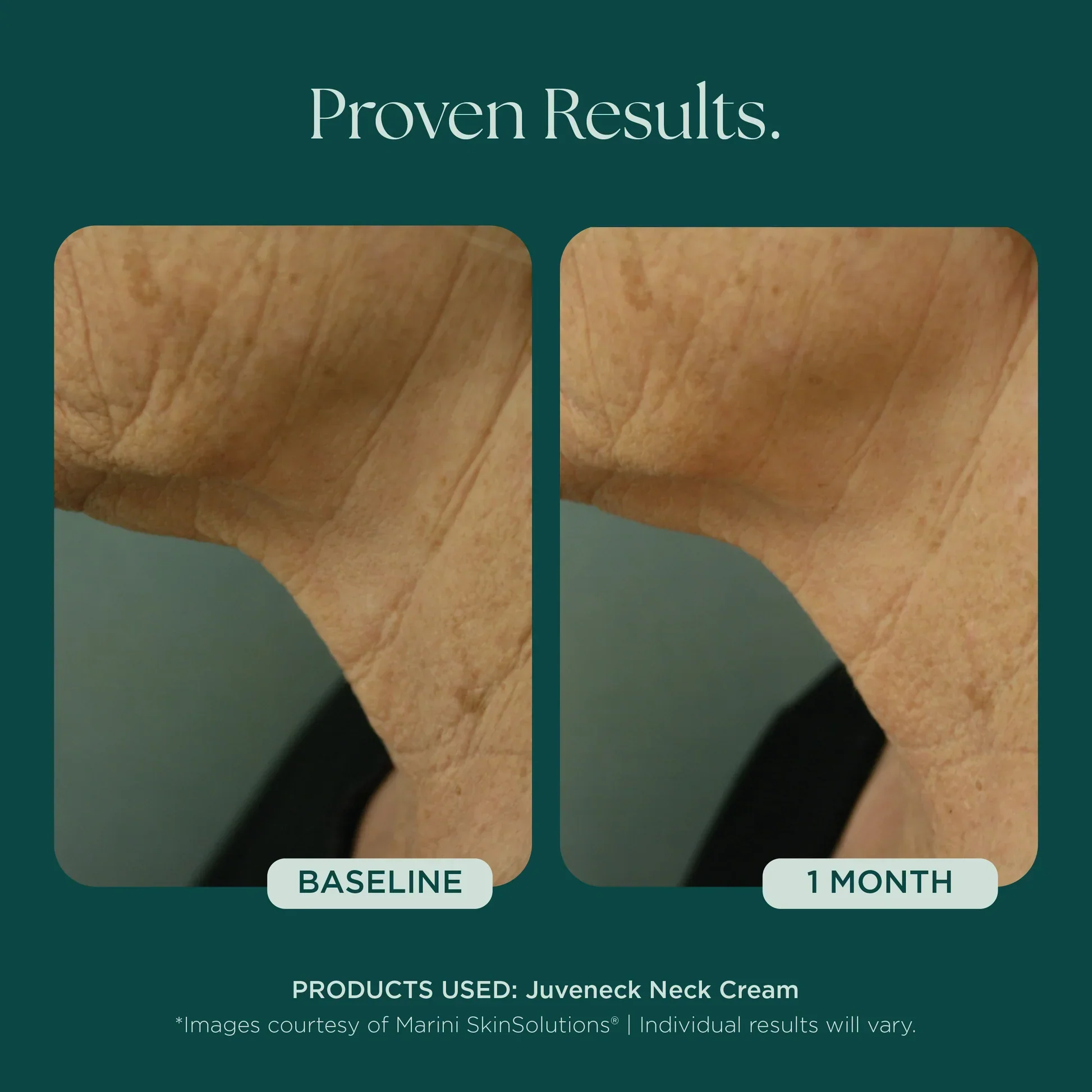 Juveneck Neck Cream - Image 4