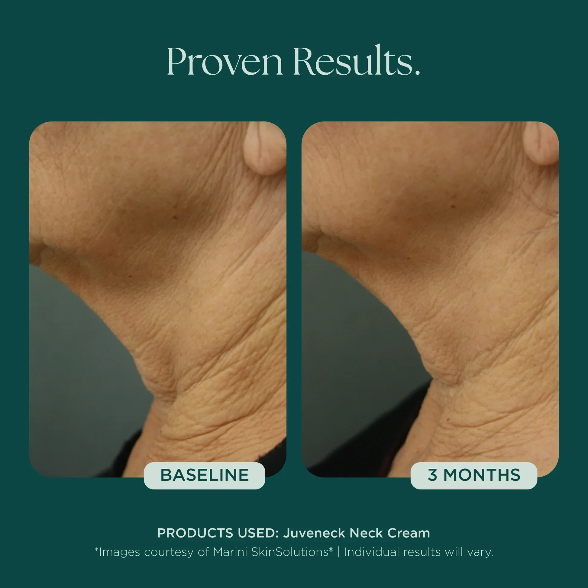Juveneck Neck Cream - Image 5