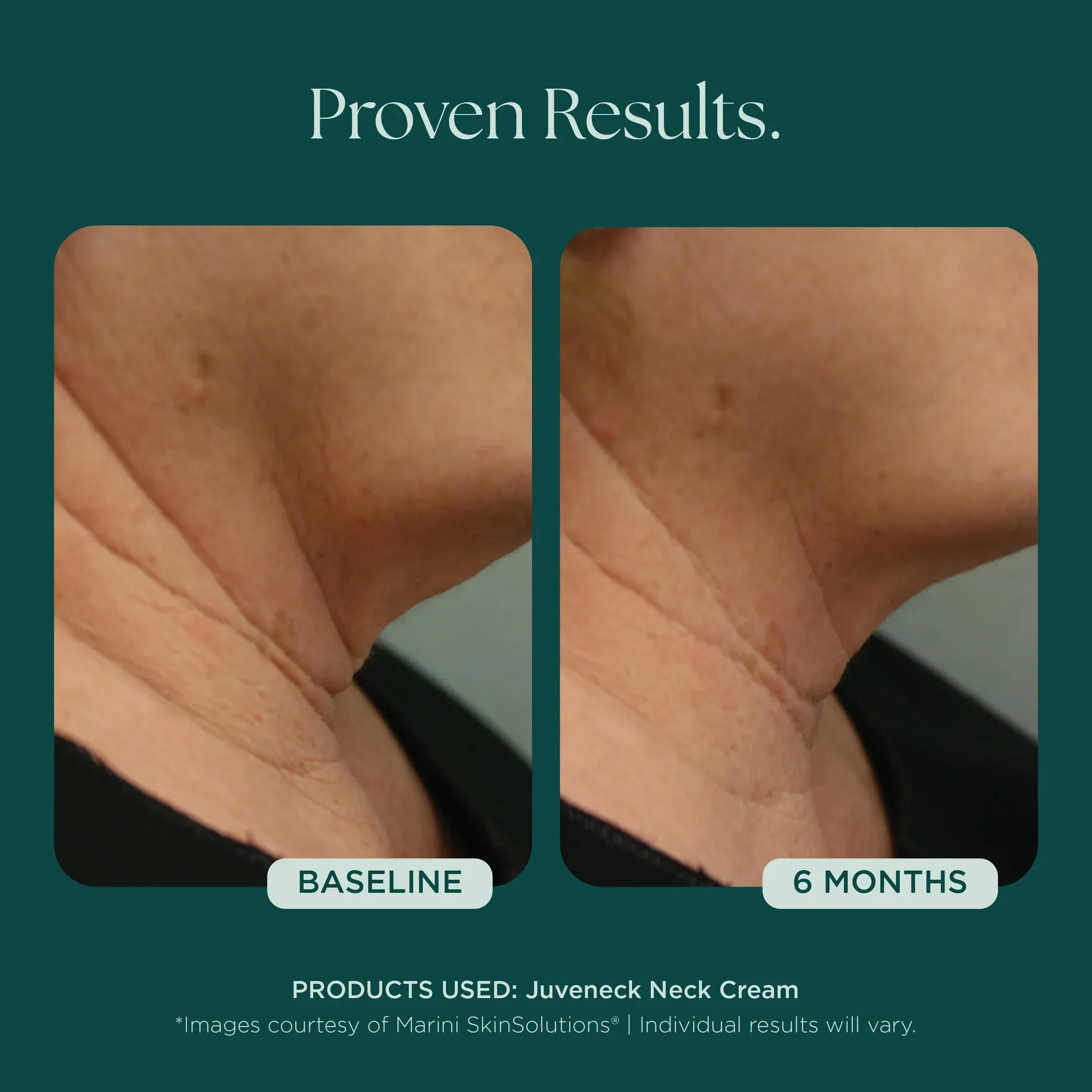 Juveneck Neck Cream - Image 6