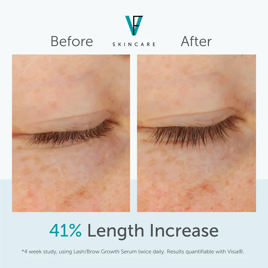 Lash/Brow Growth Serum - Image 4