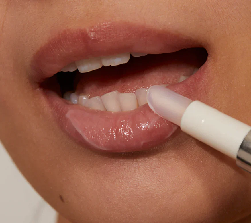 Lip Filler - Image 4