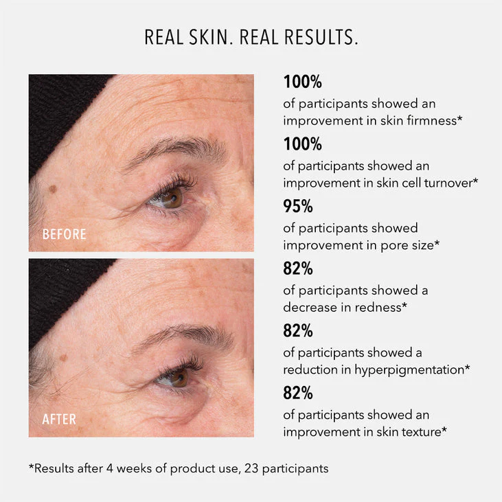 LIQUID RESURFACING SOLUTION - Daily Leave-On Exfoliant - Image 3