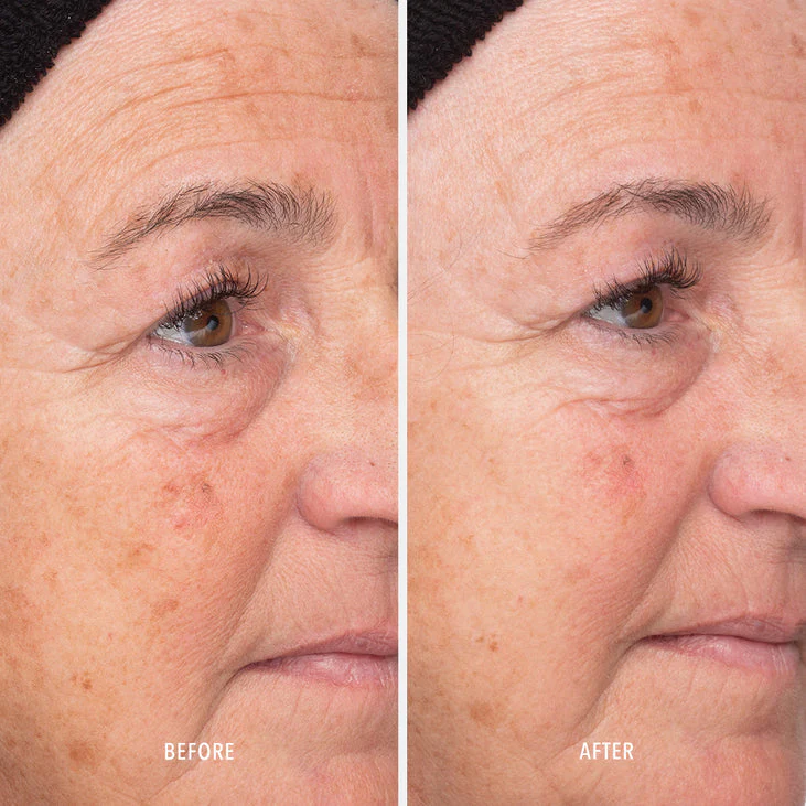 LIQUID RESURFACING SOLUTION - Daily Leave-On Exfoliant - Image 4