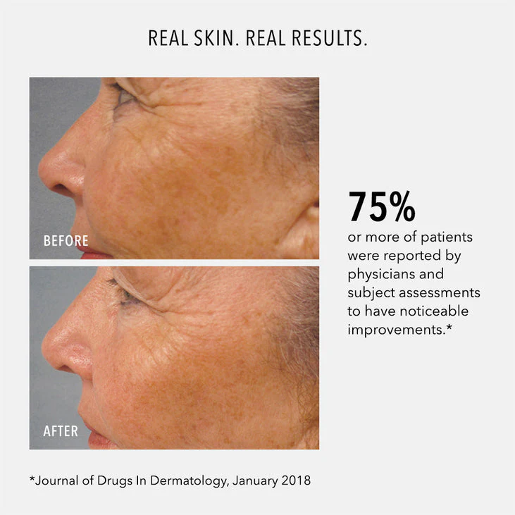 LUMAPRO-C SERUM - Skin Brightening Pigment Corrector - Image 3