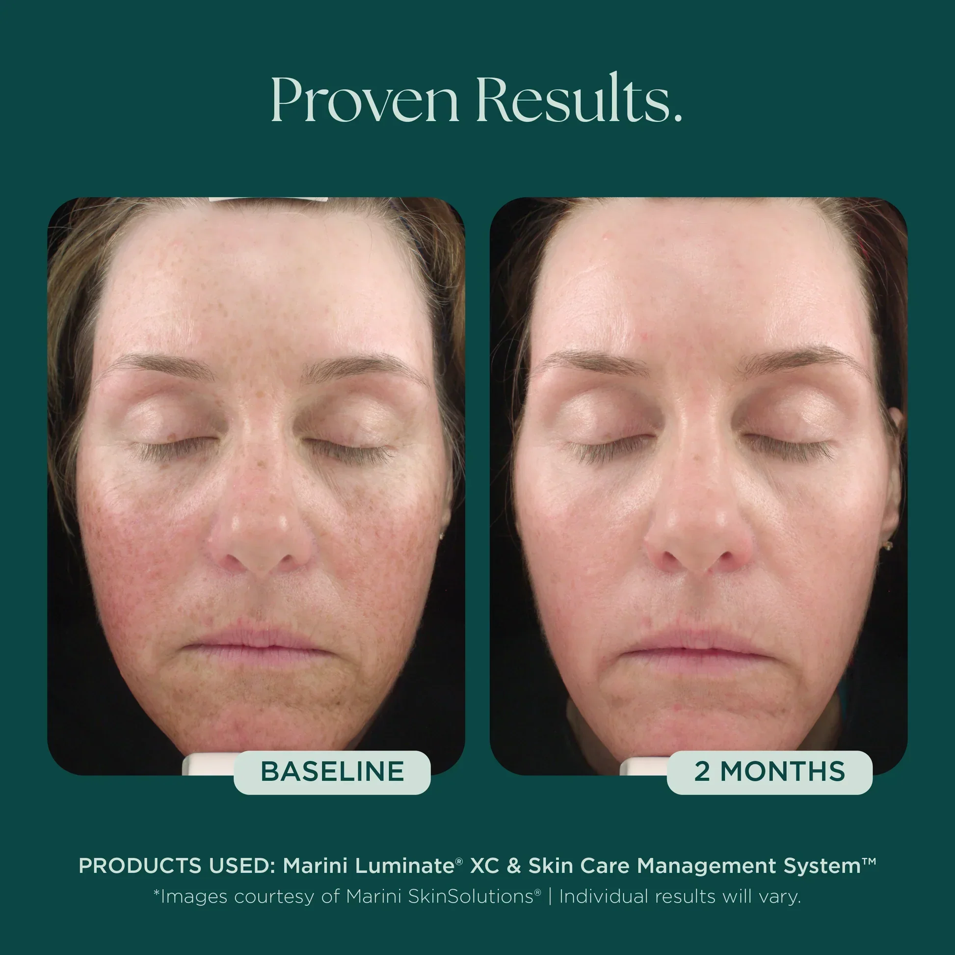 Marini Luminate® - Image 4