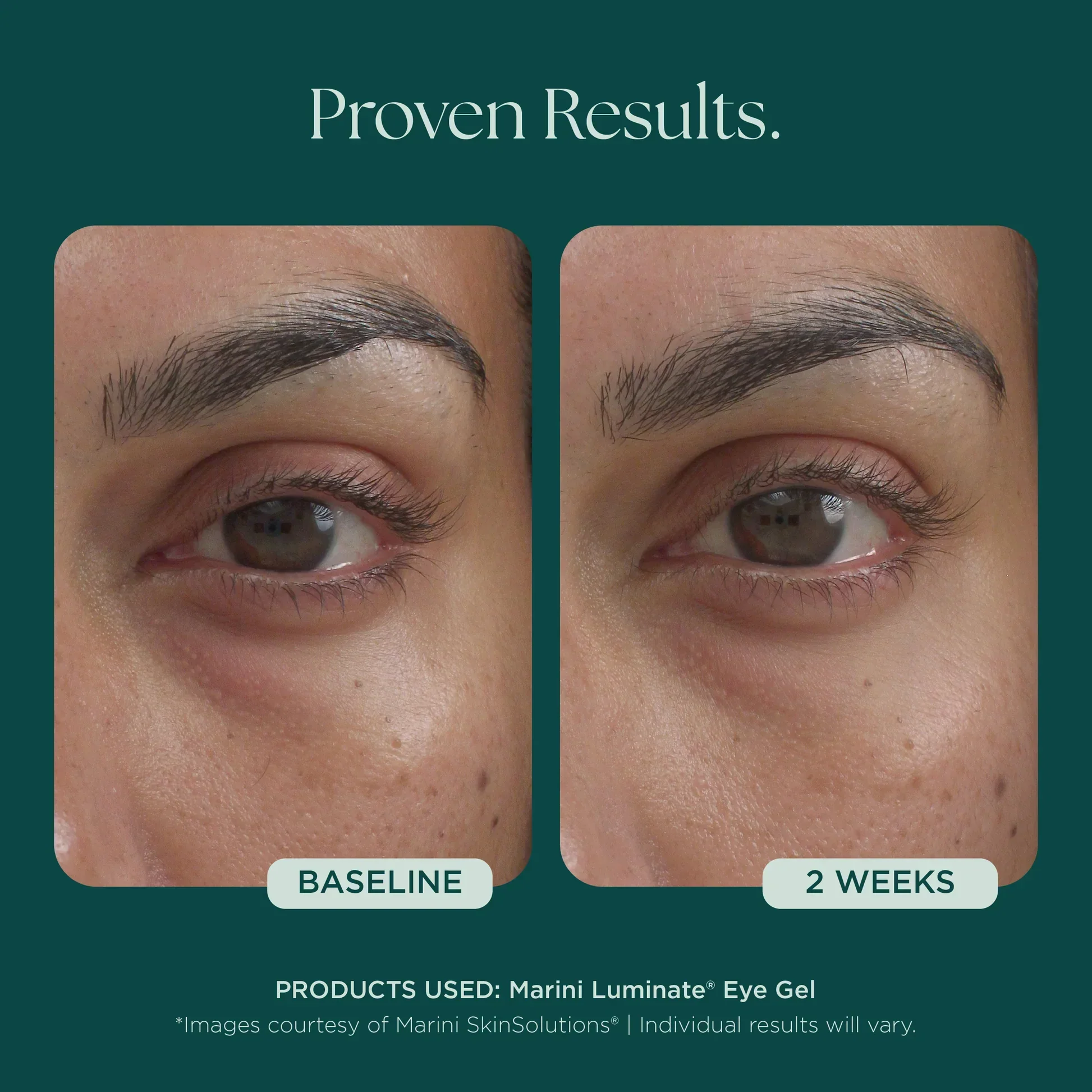 Marini Luminate® Eye Gel - Image 4