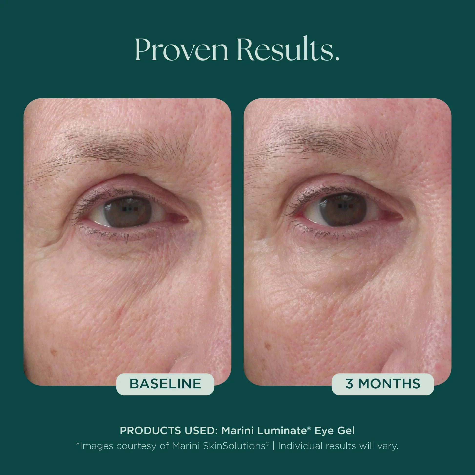 Marini Luminate® Eye Gel - Image 5