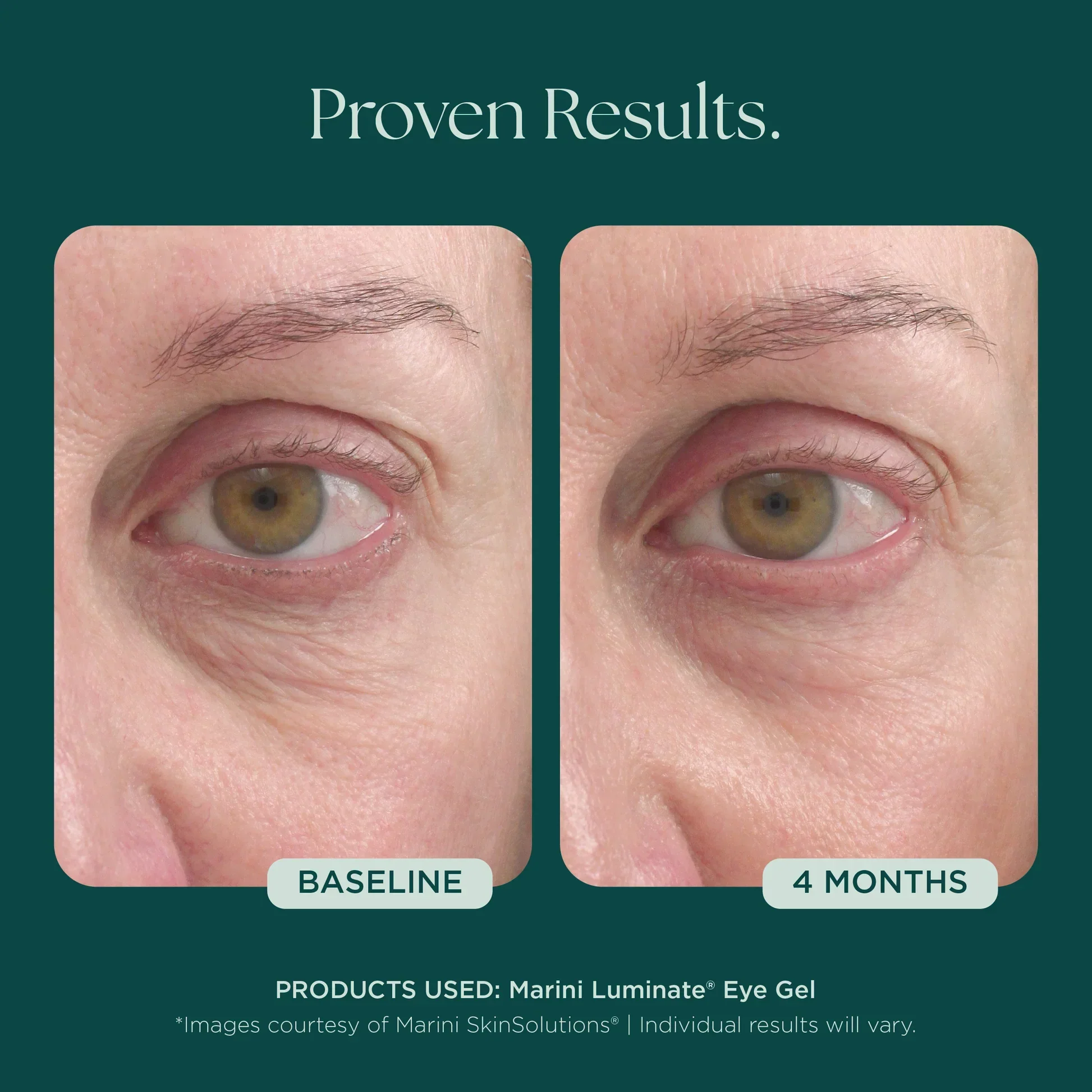 Marini Luminate® Eye Gel - Image 6
