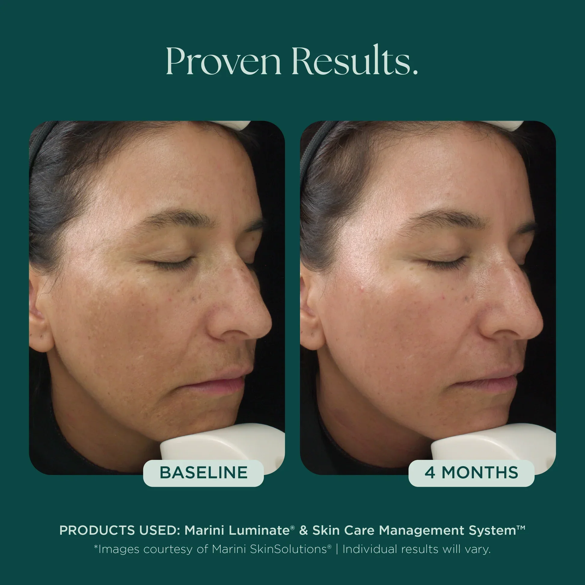 Marini Luminate® XC - Image 3