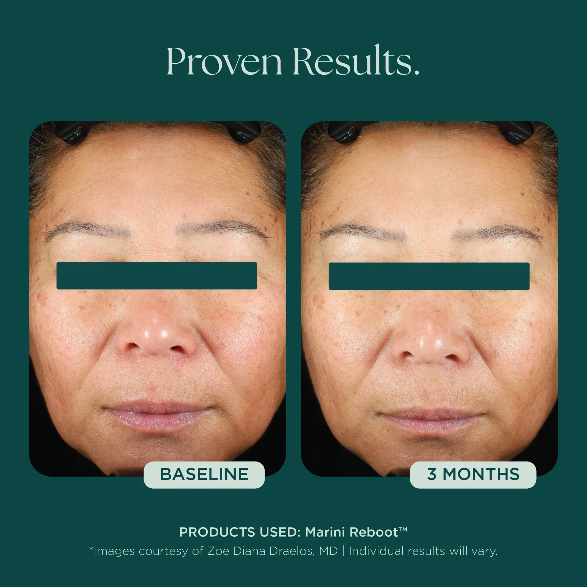 Marini Reboot® PDRN Face Serum - Image 6