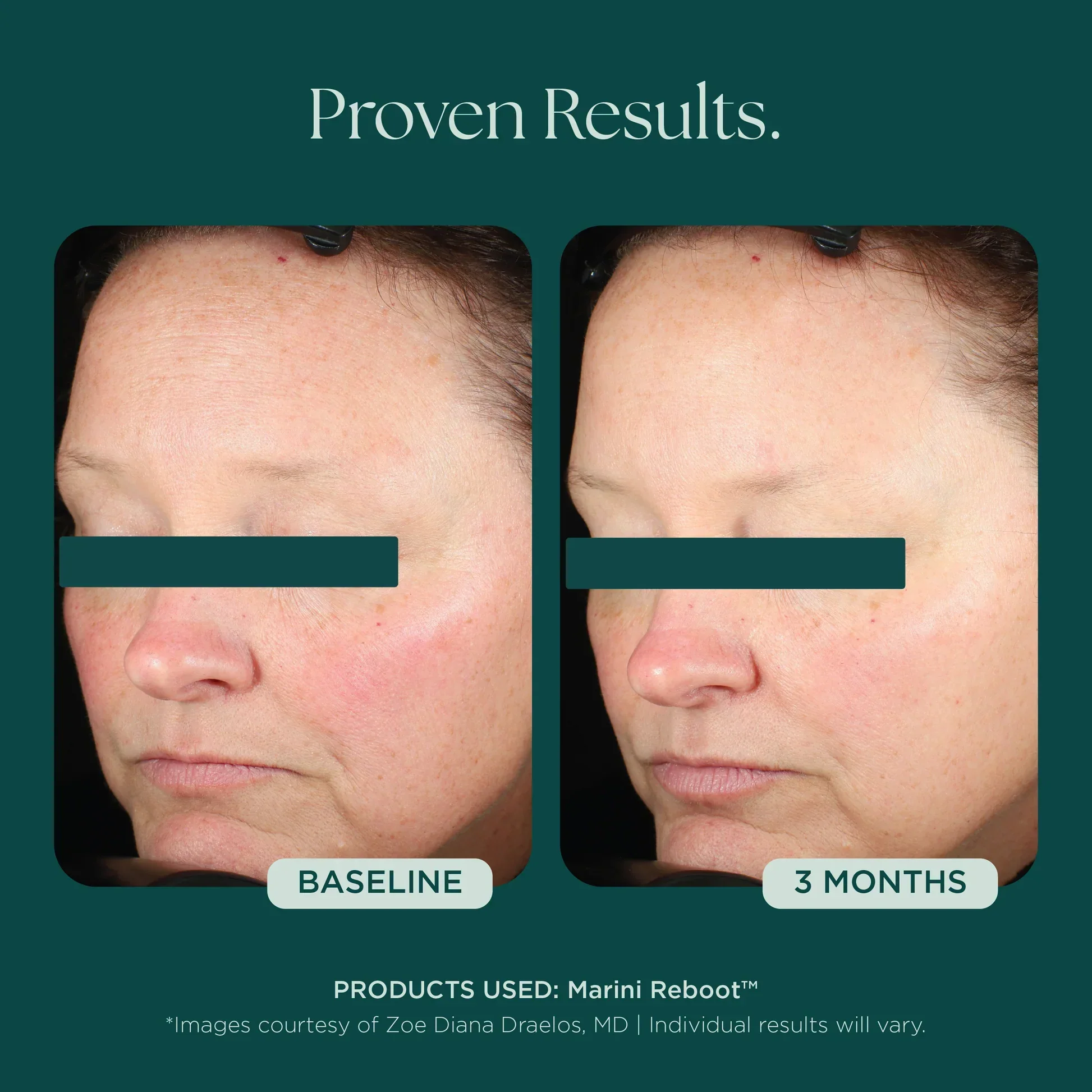 Marini Reboot® PDRN Face Serum - Image 7