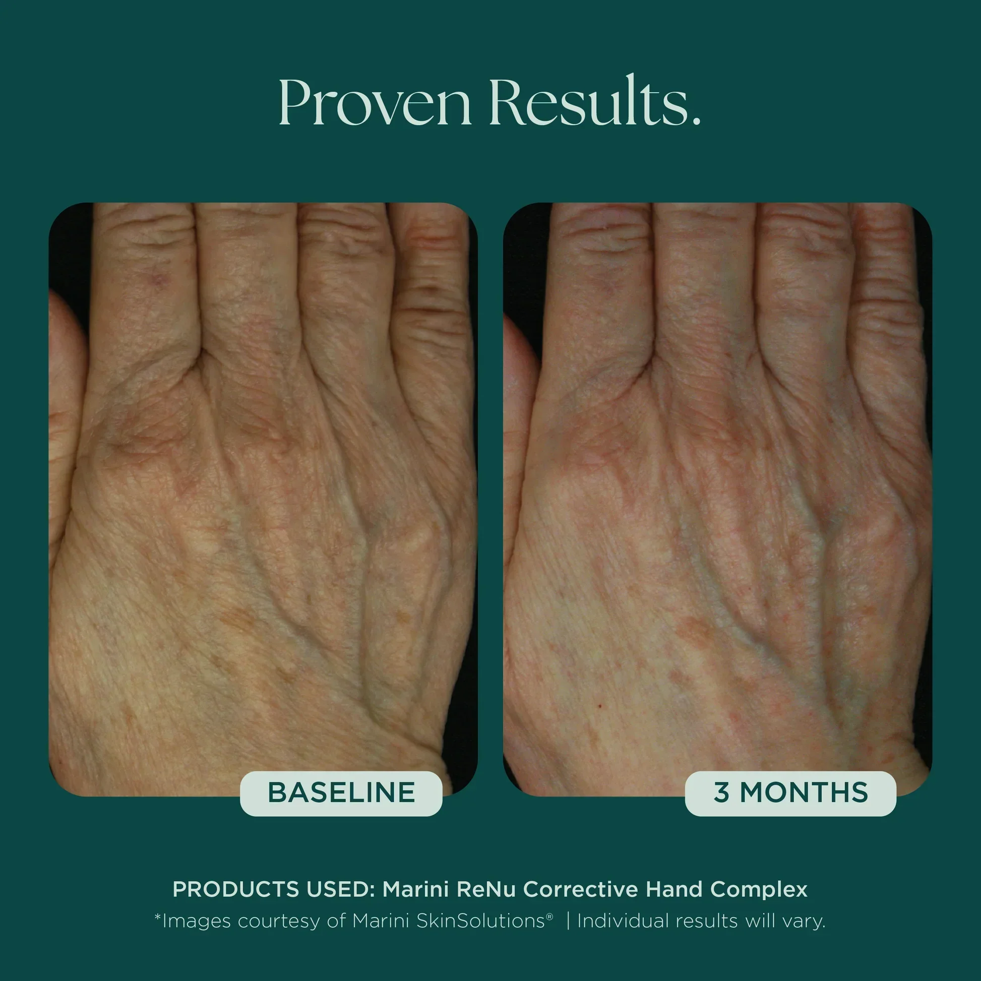Marini ReNu Corrective Hand Complex - Image 3