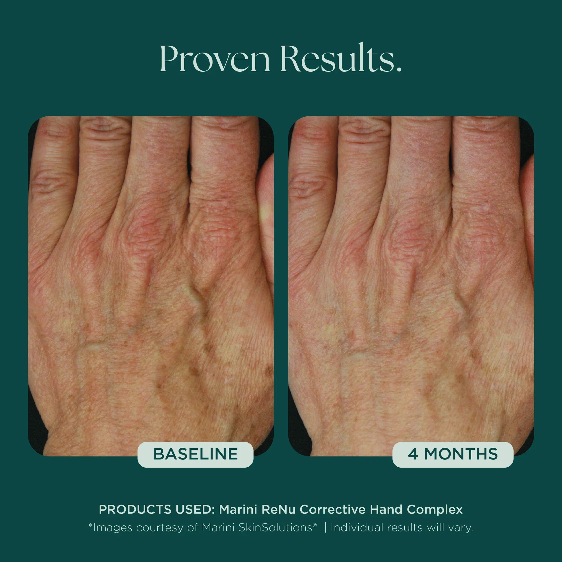 Marini ReNu Corrective Hand Complex - Image 4