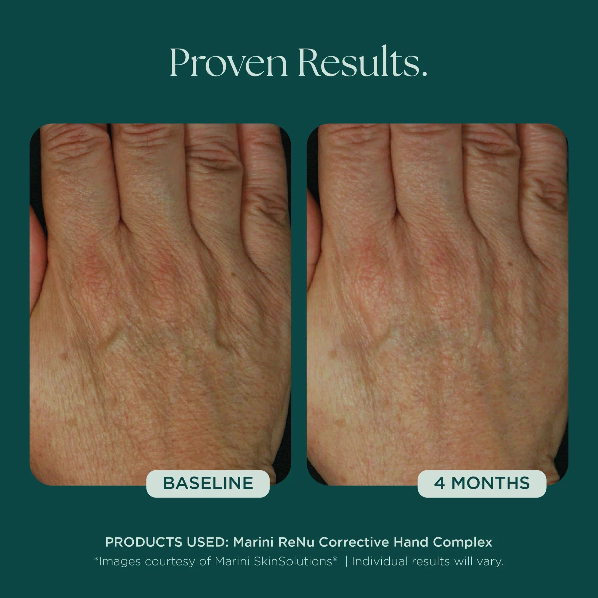 Marini ReNu Corrective Hand Complex - Image 5
