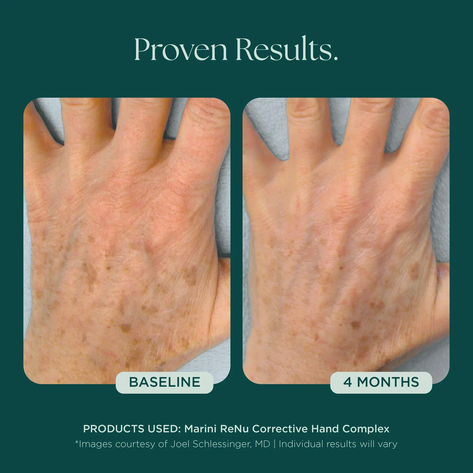 Marini ReNu Corrective Hand Complex - Image 6