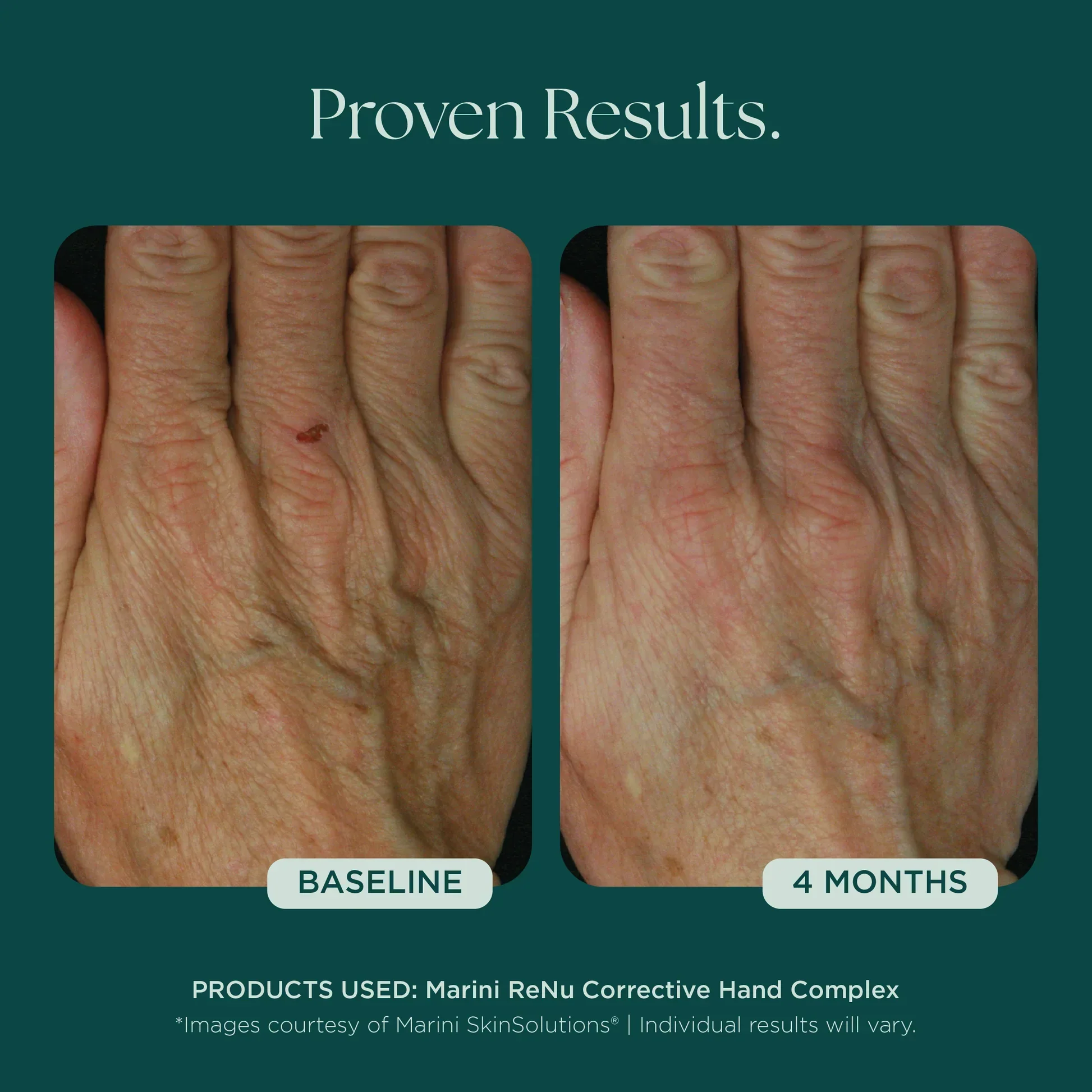 Marini ReNu Corrective Hand Complex - Image 7