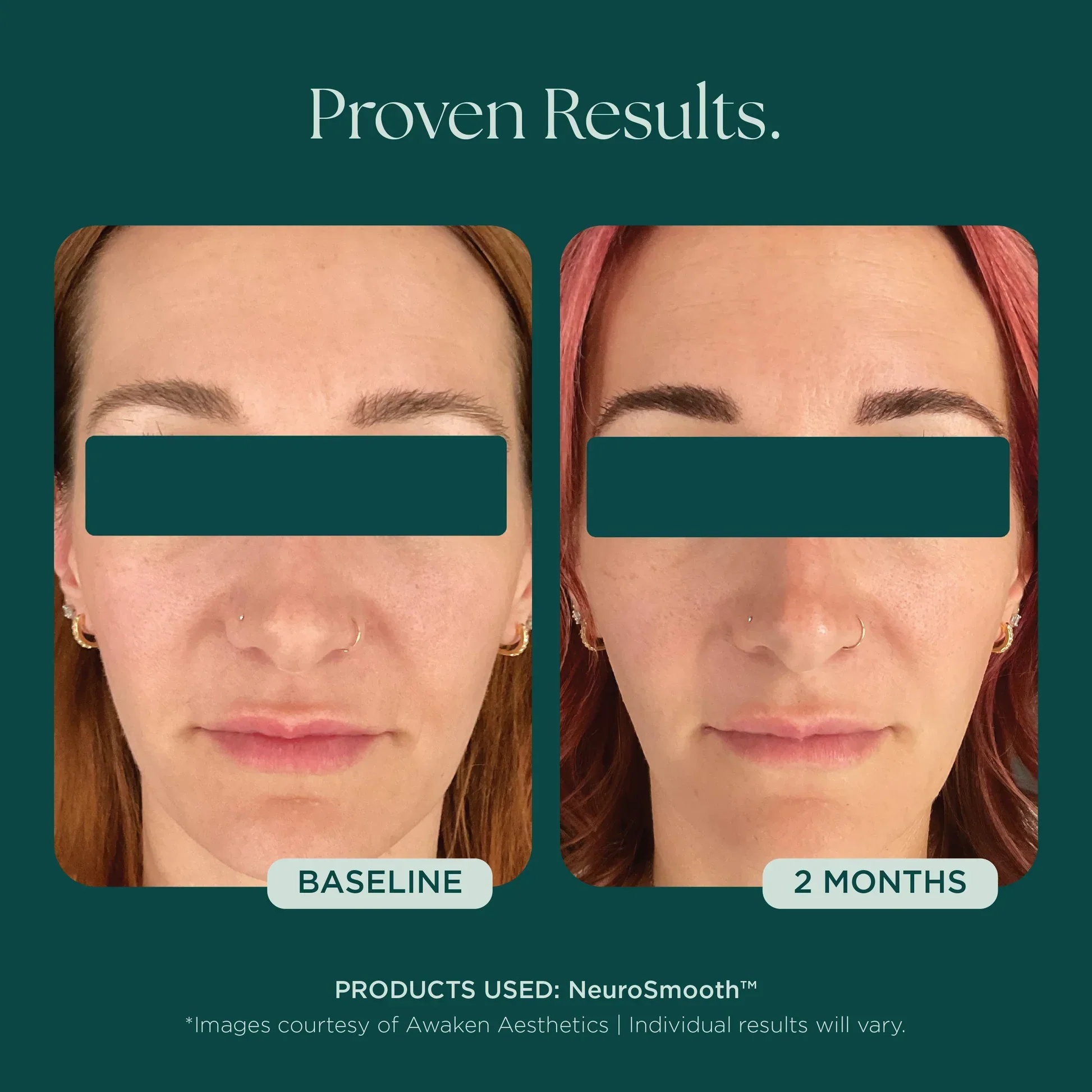 NeuroSmooth® - Image 10